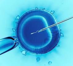 Ivf 1